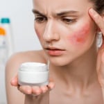 I pro e i contro della skincare a base di zinco