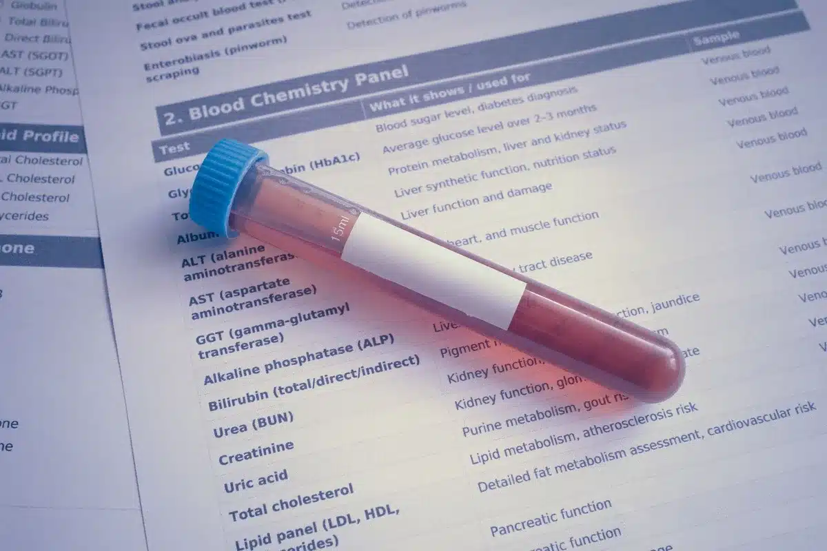 Provette di sangue e referto di analisi in laboratorio medico
