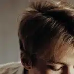 Primo piano del cuoio capelluto con desquamazione visibile e una bottiglia di shampoo antiforfora