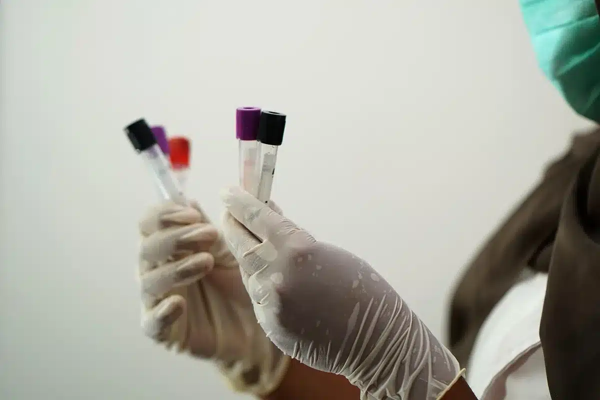 Campioni di sangue etichettati su vassoio per analisi